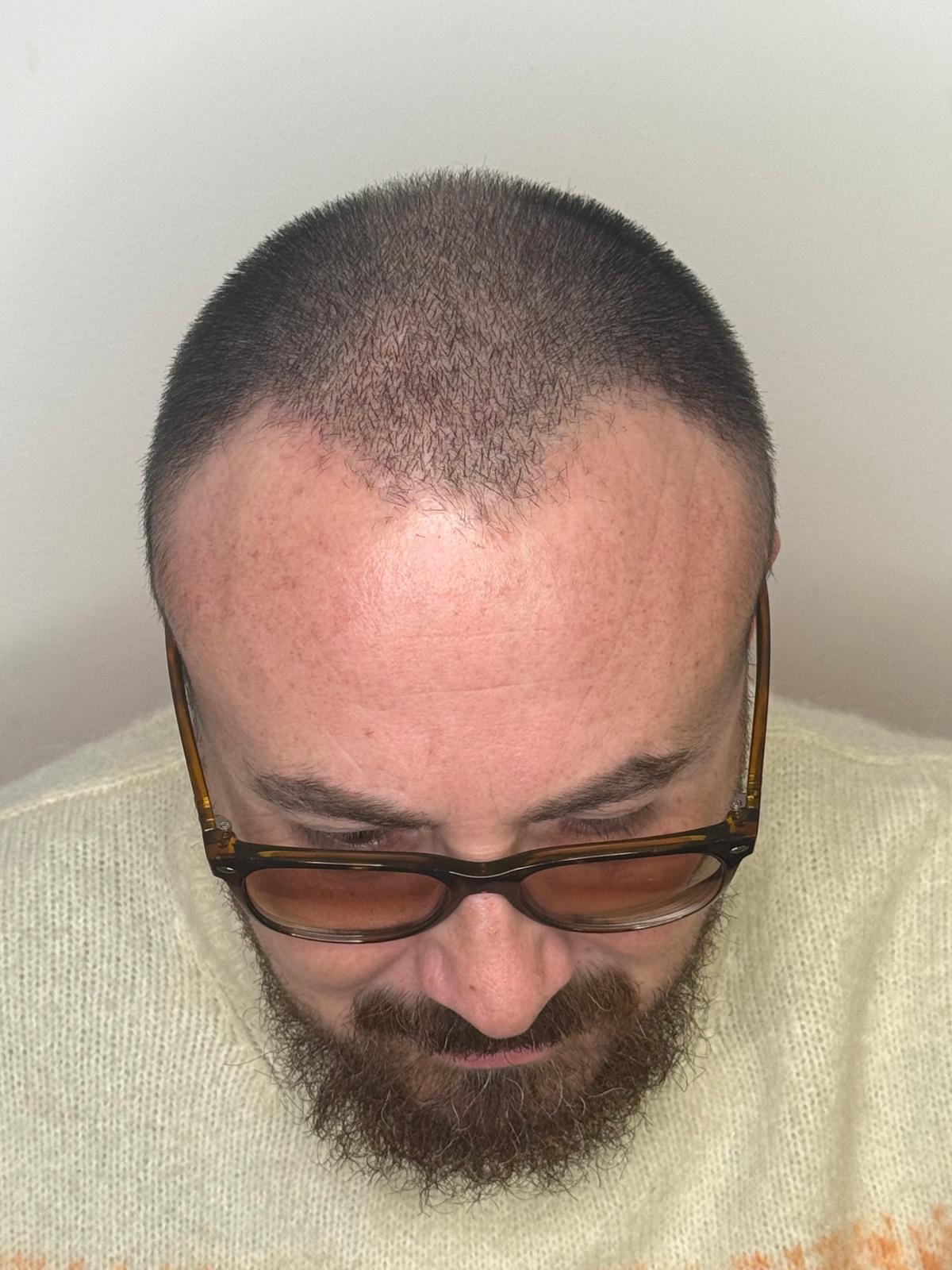 Dopo il trattamento